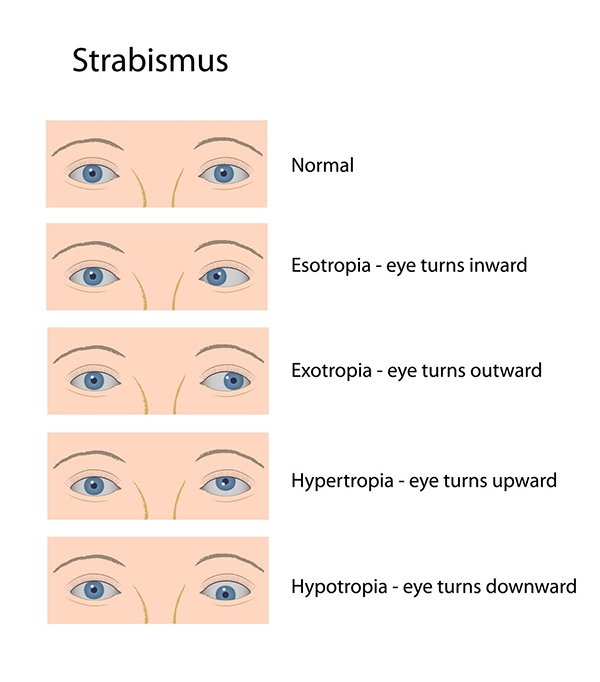 best optometrist in staten island